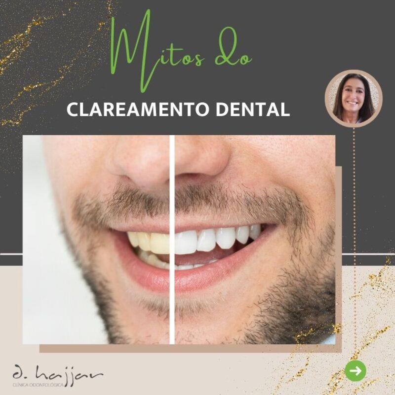 mitos do clareamento dental