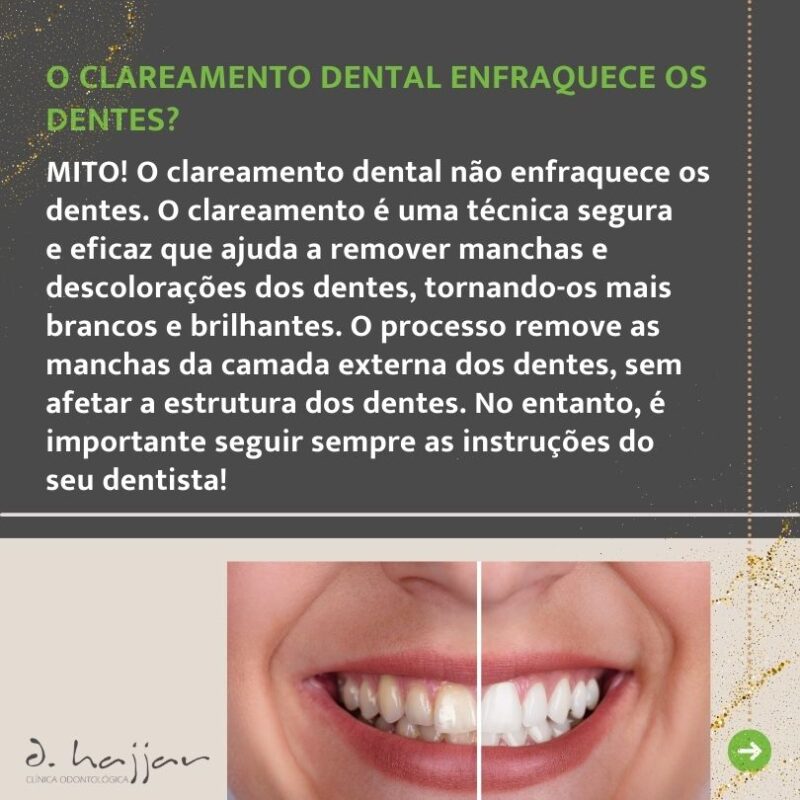mitos do clareamento dental2